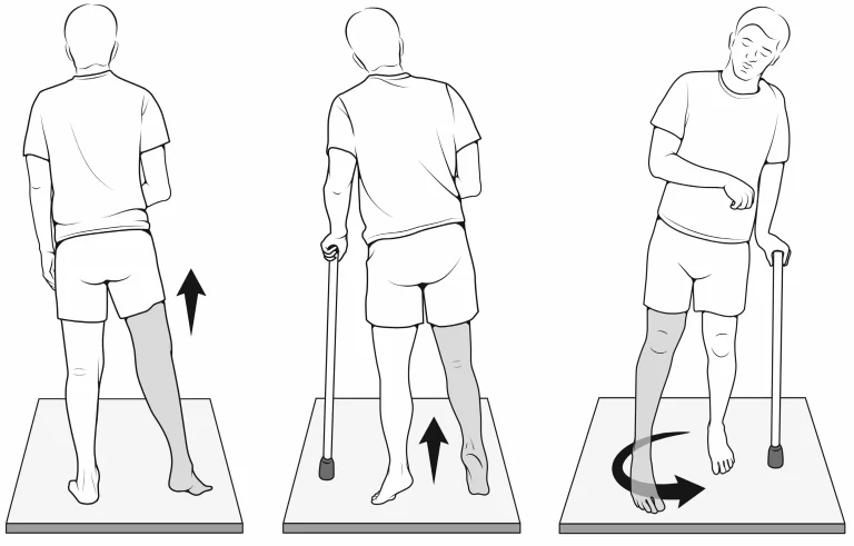 Tricep Strain - PhysioAdvisor