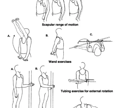 rotator cuff exercises dumbbell Archives - SAMARPAN PHYSIOTHERAPY ...