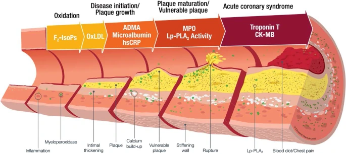 Atherosclerosis