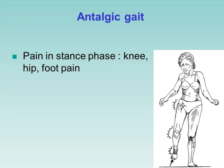 Antalgic Gait