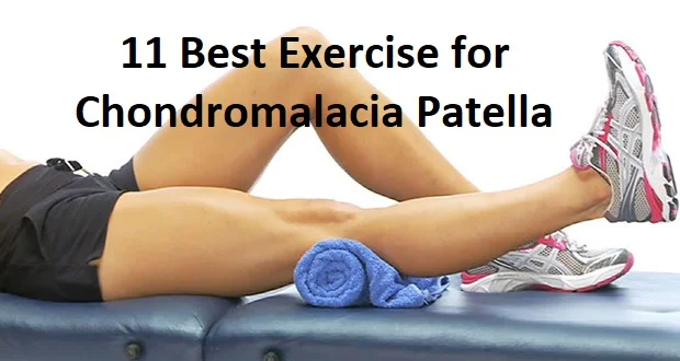 Exercise for Chondromalacia Patella