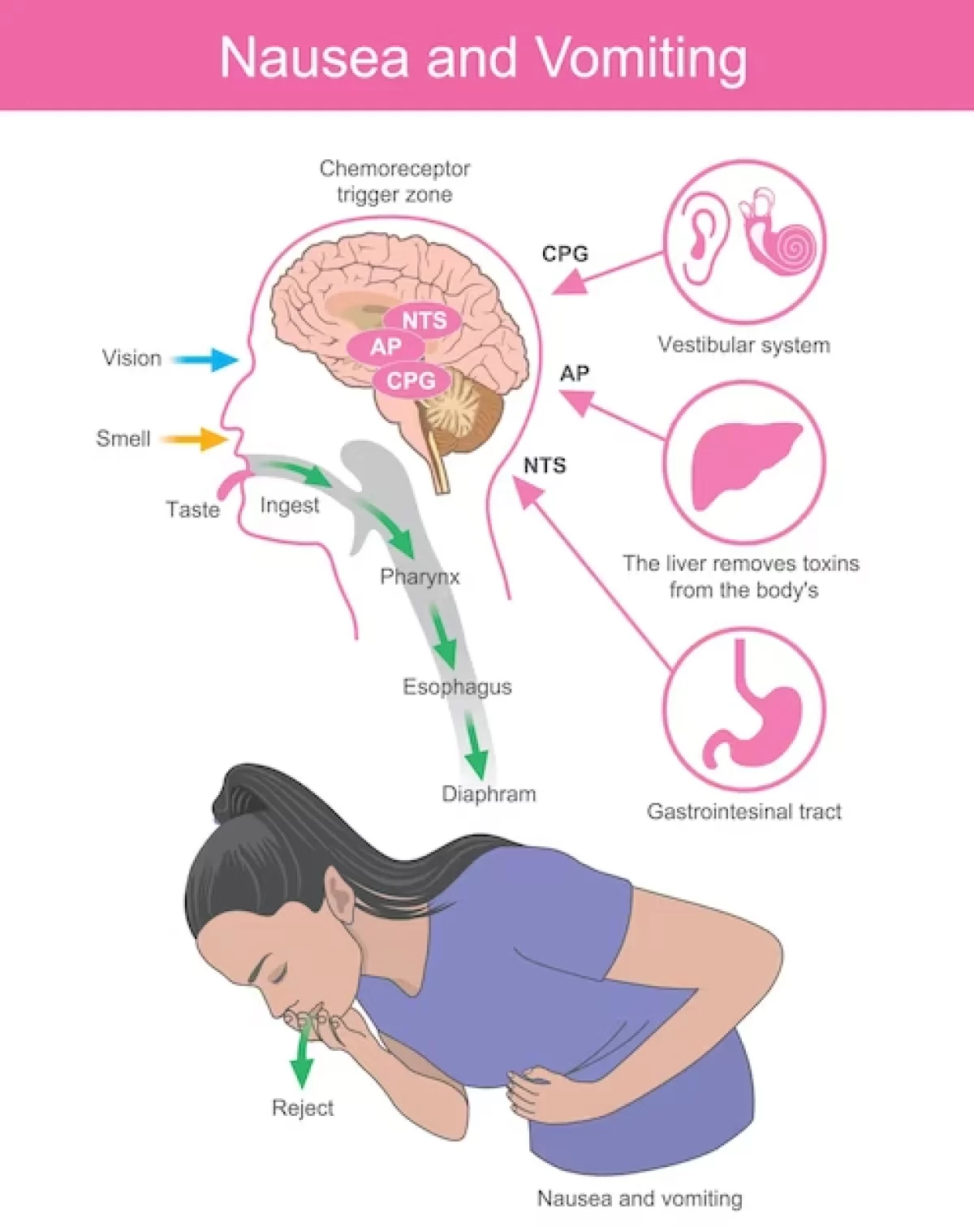 Correlation between the development of symptoms of nausea in the first