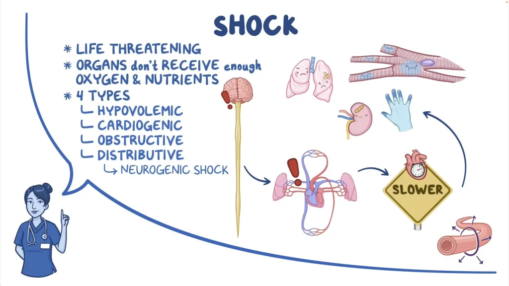 What is the clinical 2025 hallmark of neurogenic shock