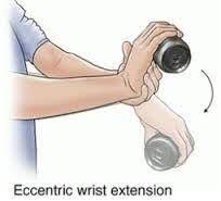 wrist-extension
