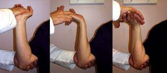 Ulnar styloid triquetral impaction [ USTI ] provocation test