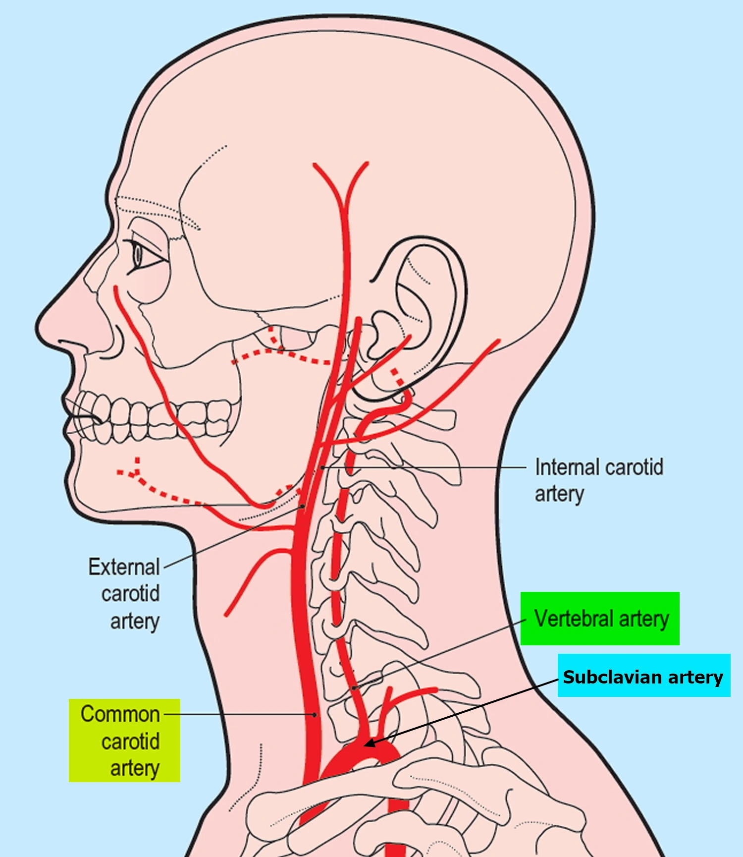 Vertebral Artery Dissection Symptoms Risk Factor Treatment