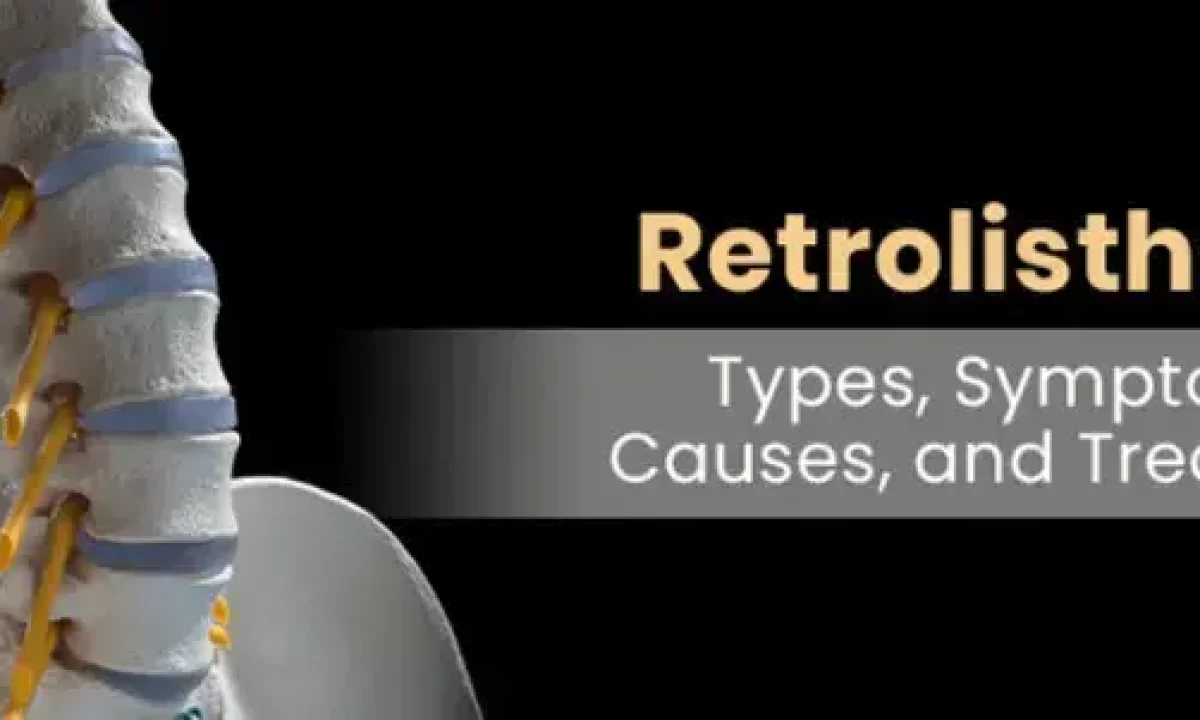 Retrolisthesis: Types, Symptoms, Causes, And Treatment, 49% OFF