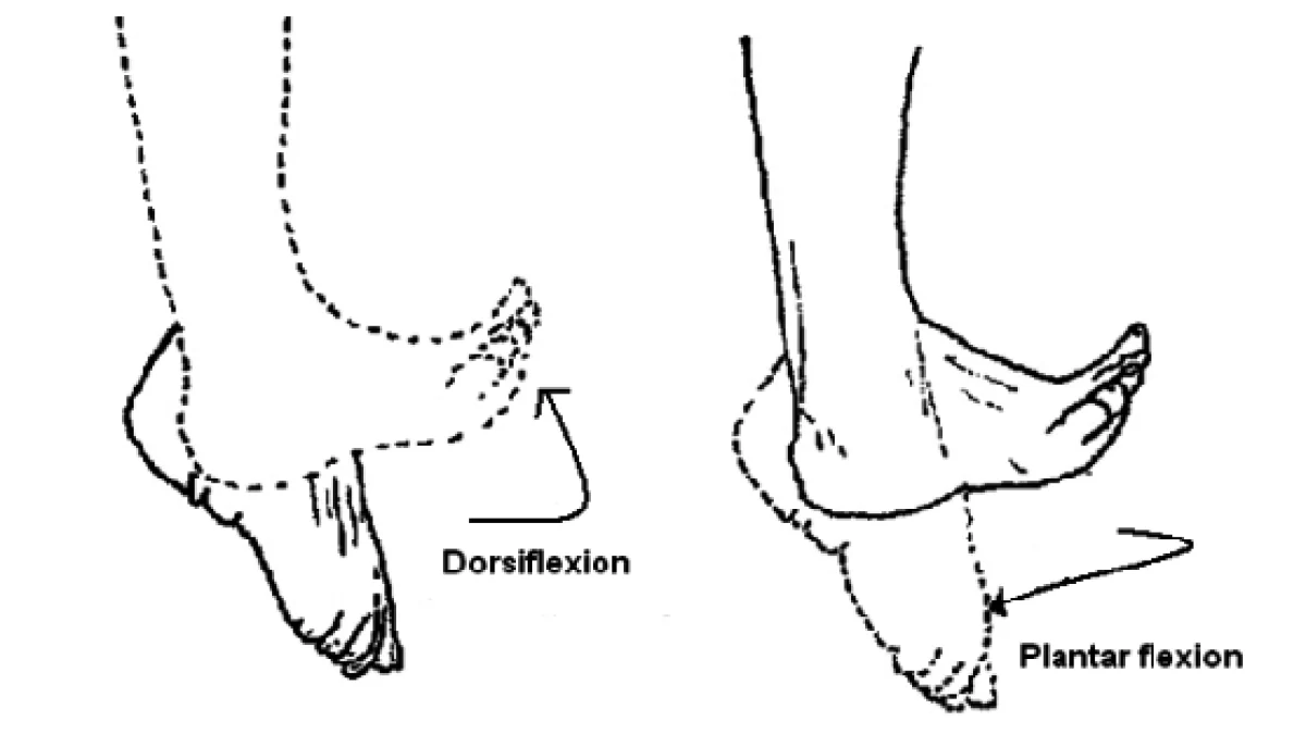 when the knee is extended the ankle cannot be passively dorsiflexed to