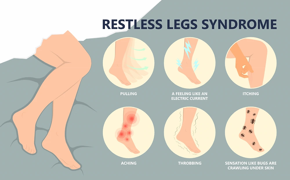 Managing Restless Legs Syndrome With Exercise: Tips for Safe and