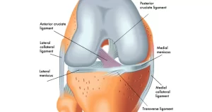 anterior cruciate ligament (ACL)