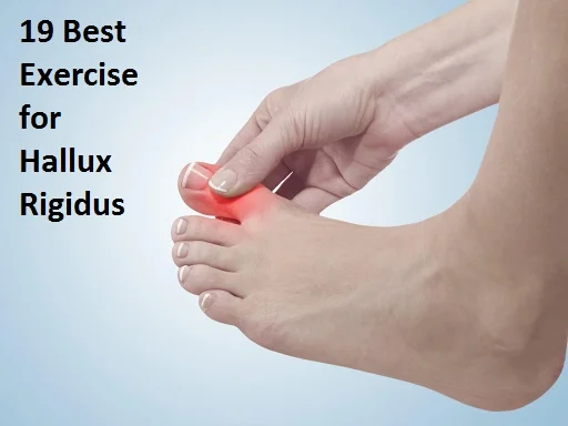 19 Best Exercise for Hallux Rigidus - Samarpan Physio