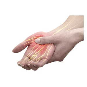 Latrogenic Nerve Injury