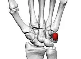 Pisiform Bone - Anatomy, Structure, Function