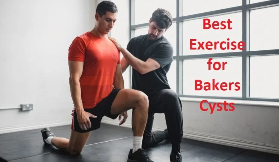 Managing Baker S Cyst Symptoms With Exercises Archives Samarpan Physiotherapy Clinic