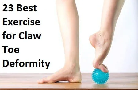 Best Exercise for Claw Toe Deformity