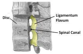 Ligamentum Flavum - Anatomy, Structure, Function