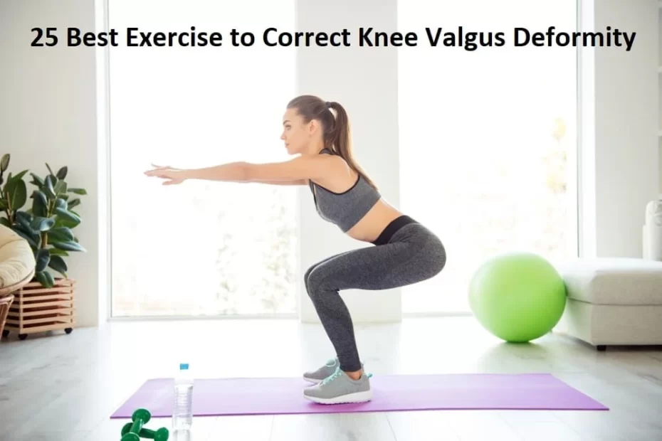 25 Best Exercise to Correct Knee Valgus Deformity