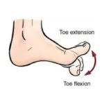 teo-flexion-and-extension-