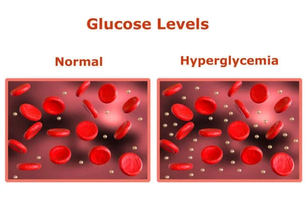 high blood sugar (hyperglycemia)
