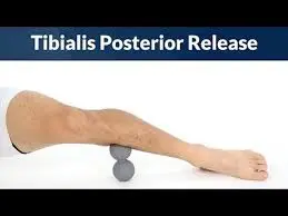 tibialis-posteior-release