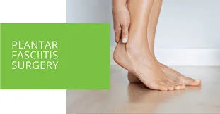 Plantar Fascitis Surgery What To Expect Before During And After   Plantar Fascitis Surgery.webp