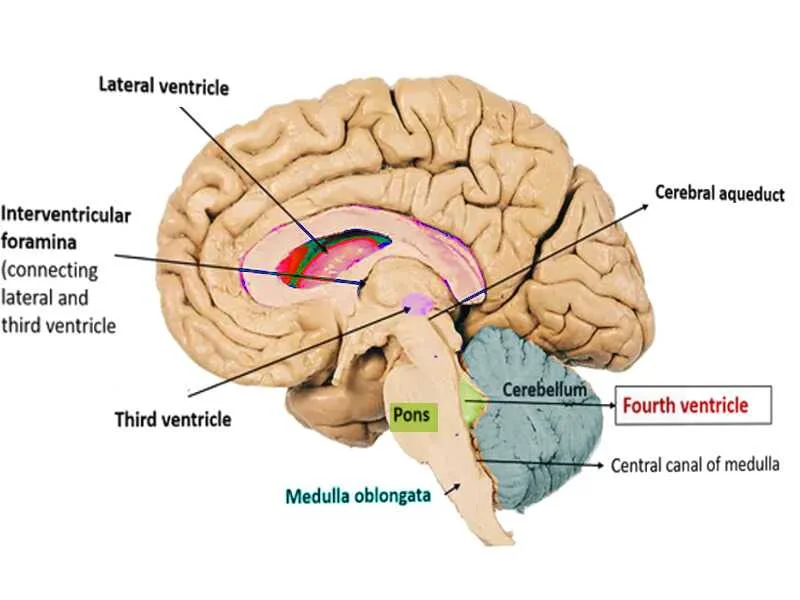 brain ventricle