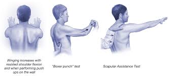 serratus-anterior-test